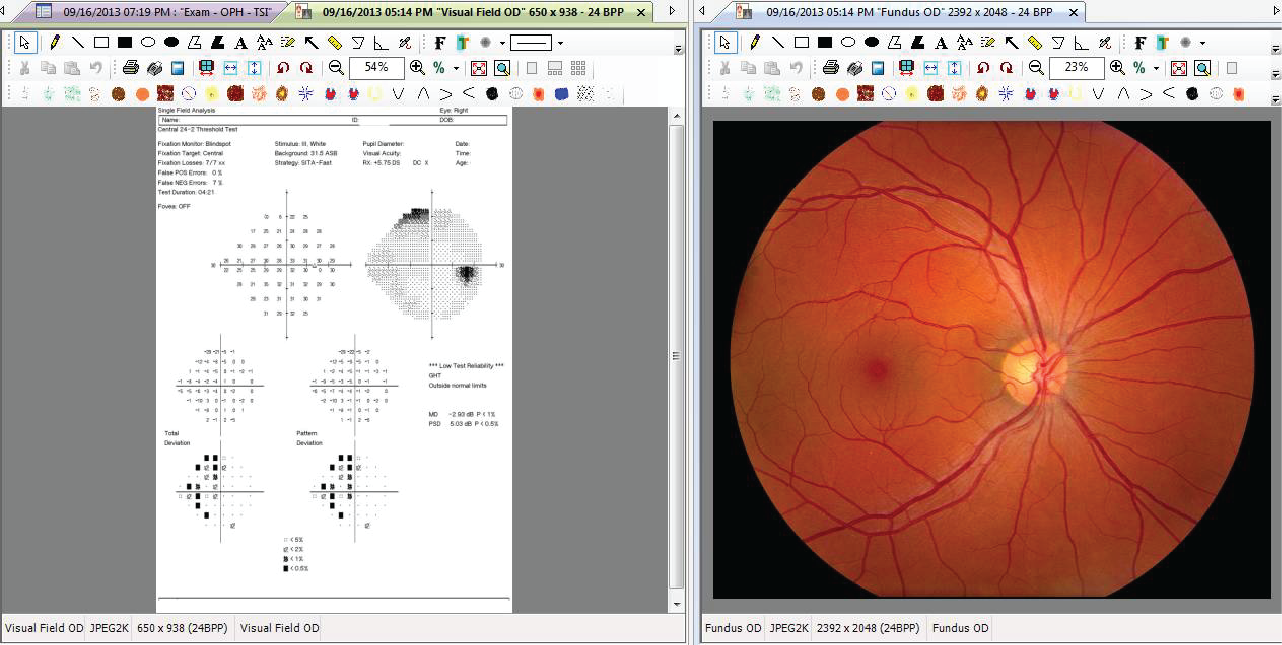 ophthalmology specific EHR content